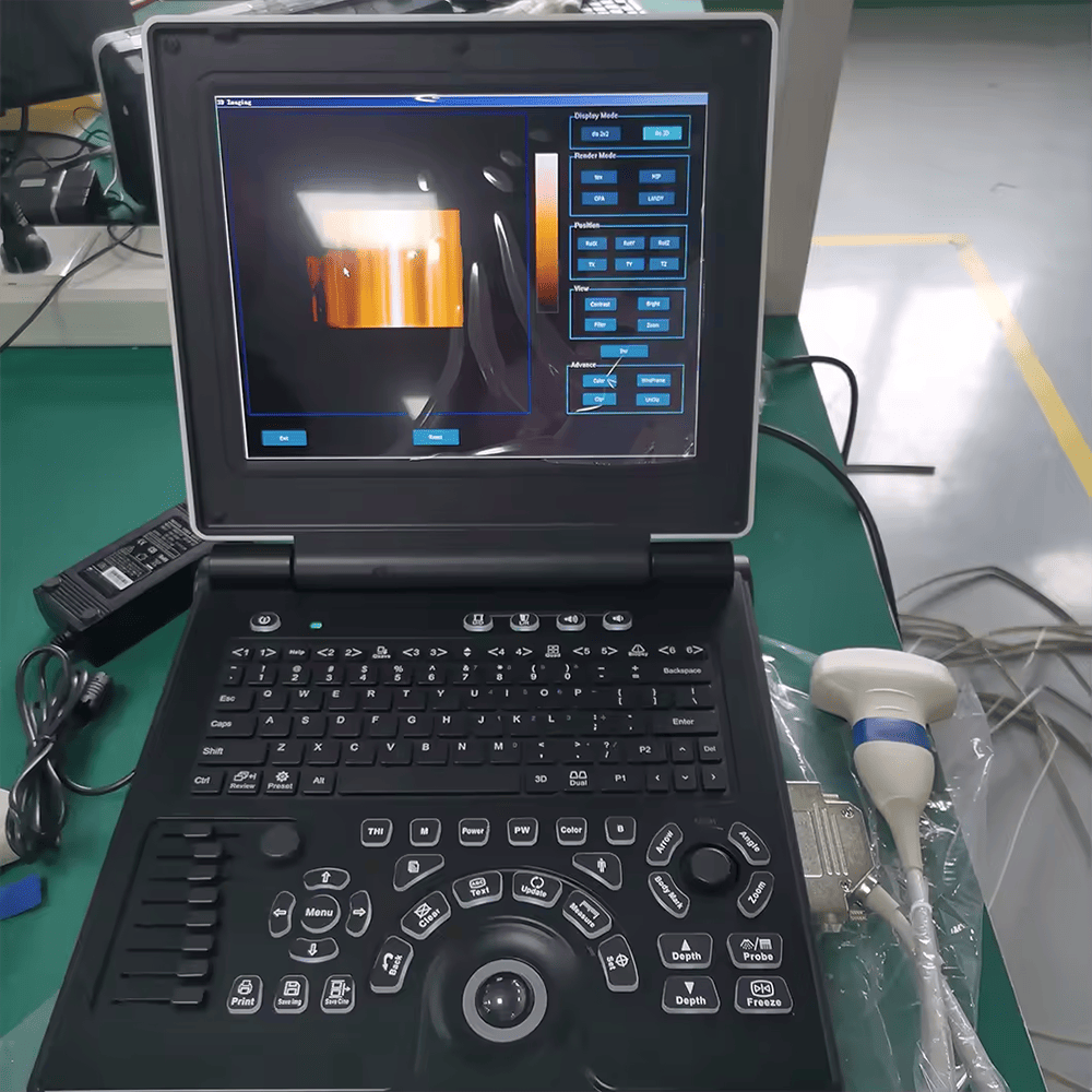 Medical Ultrasound Instruments China Cheapest Color Doppler Ob/Gyn Portable Ultrasound Scan Machine