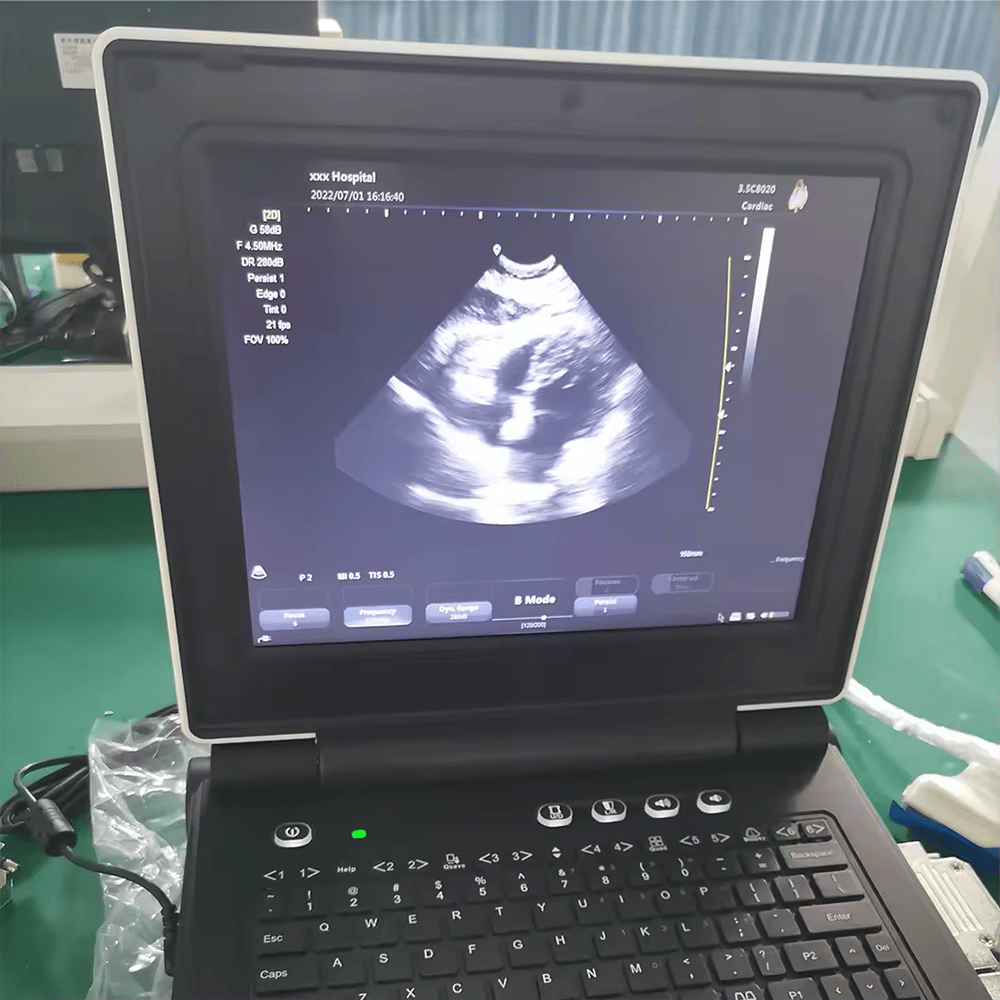 Medical Ultrasound Instruments China Cheapest Color Doppler Ob/Gyn Portable Ultrasound Scan Machine