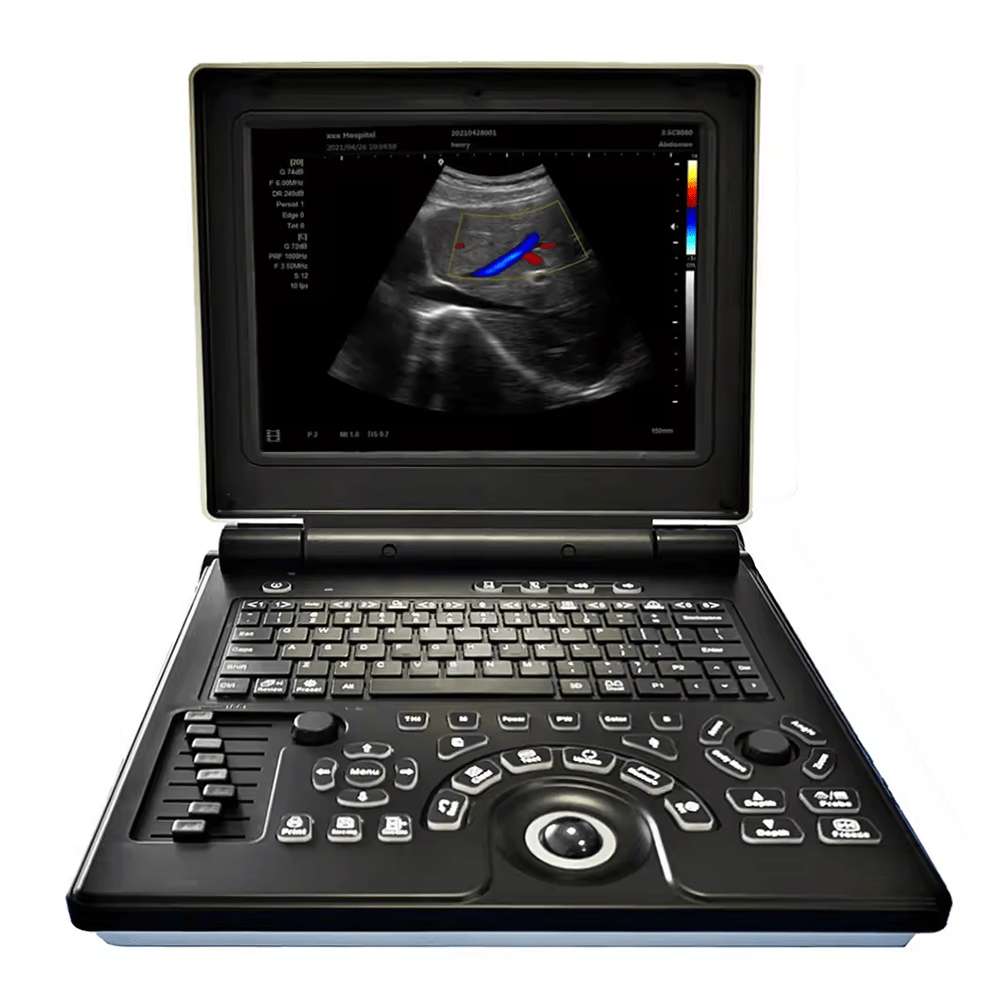 Medical Ultrasound Instruments China Cheapest Color Doppler Ob/Gyn Portable Ultrasound Scan Machine