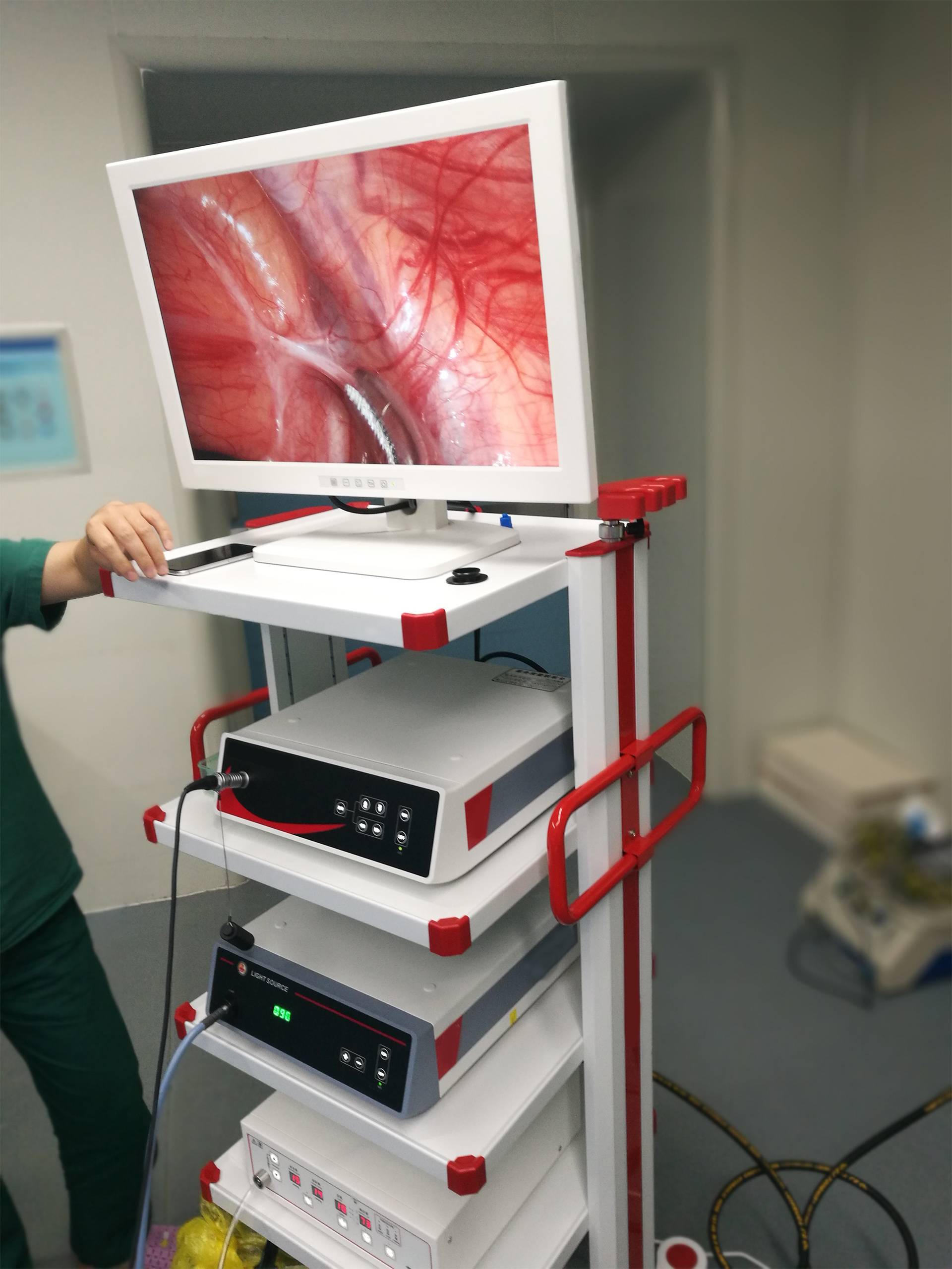 Medical Surgical Laparoscopy Set Endoscope
