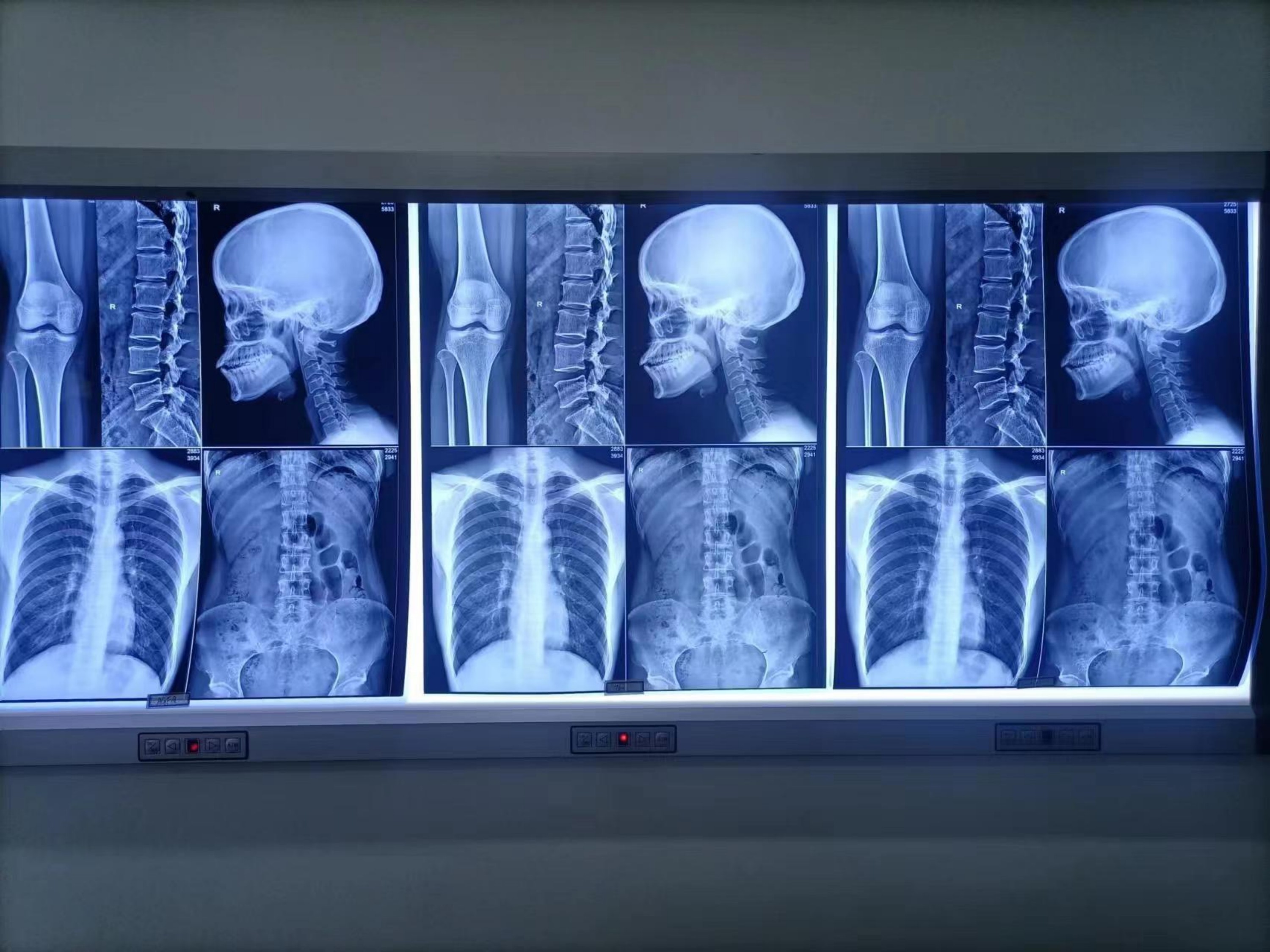 Direct x ray printer For Hospital MQ-460DY