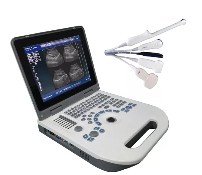 MBW-3P Full Digital Portable B/W Ultrasound Scanner