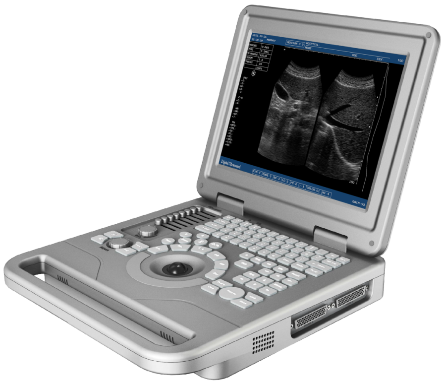 MBW-3P Full Digital Portable B/W Ultrasound Scanner