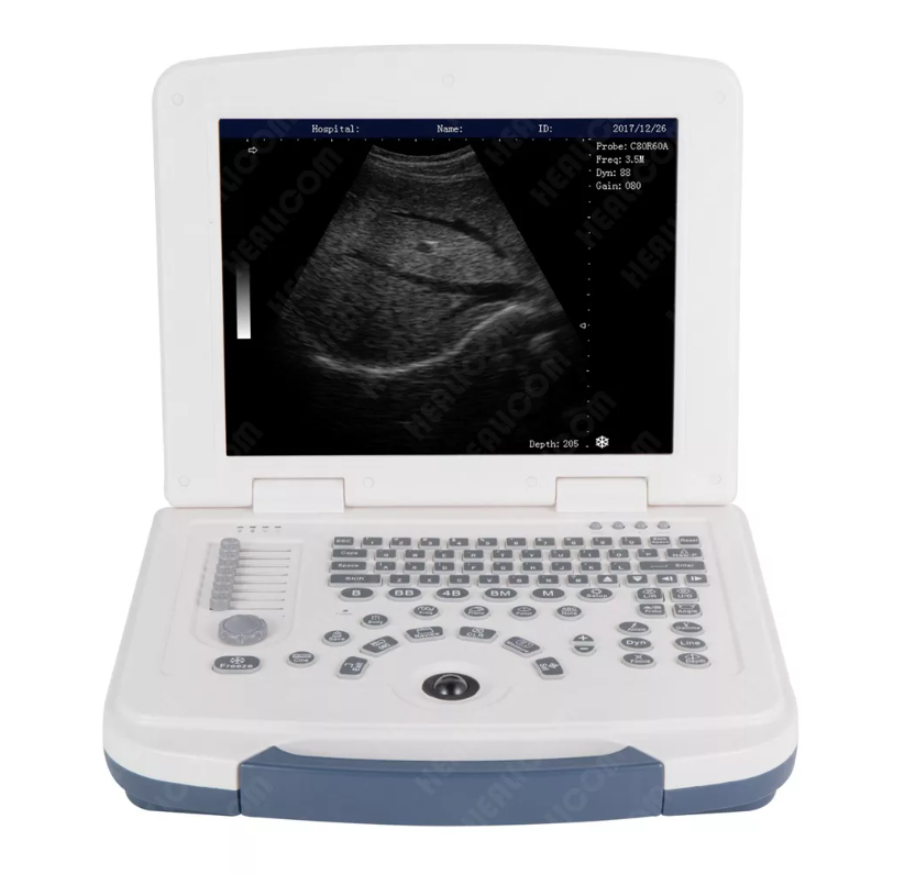 MBW-4 Fully Digital Laptop Black and White Ultrasonic Scanner