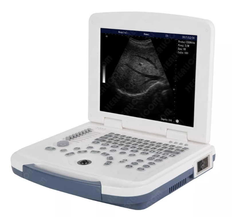 MBW-4 Fully Digital Laptop Black and White Ultrasonic Scanner