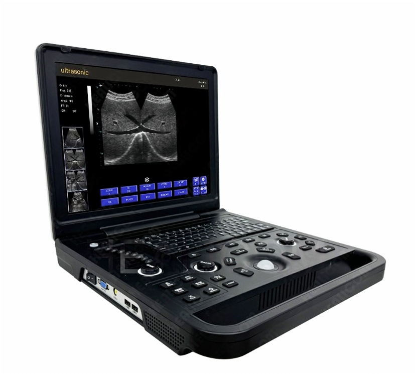 MBW-5P Medical Portable Full Digital B/W Ultrasound Scanner
