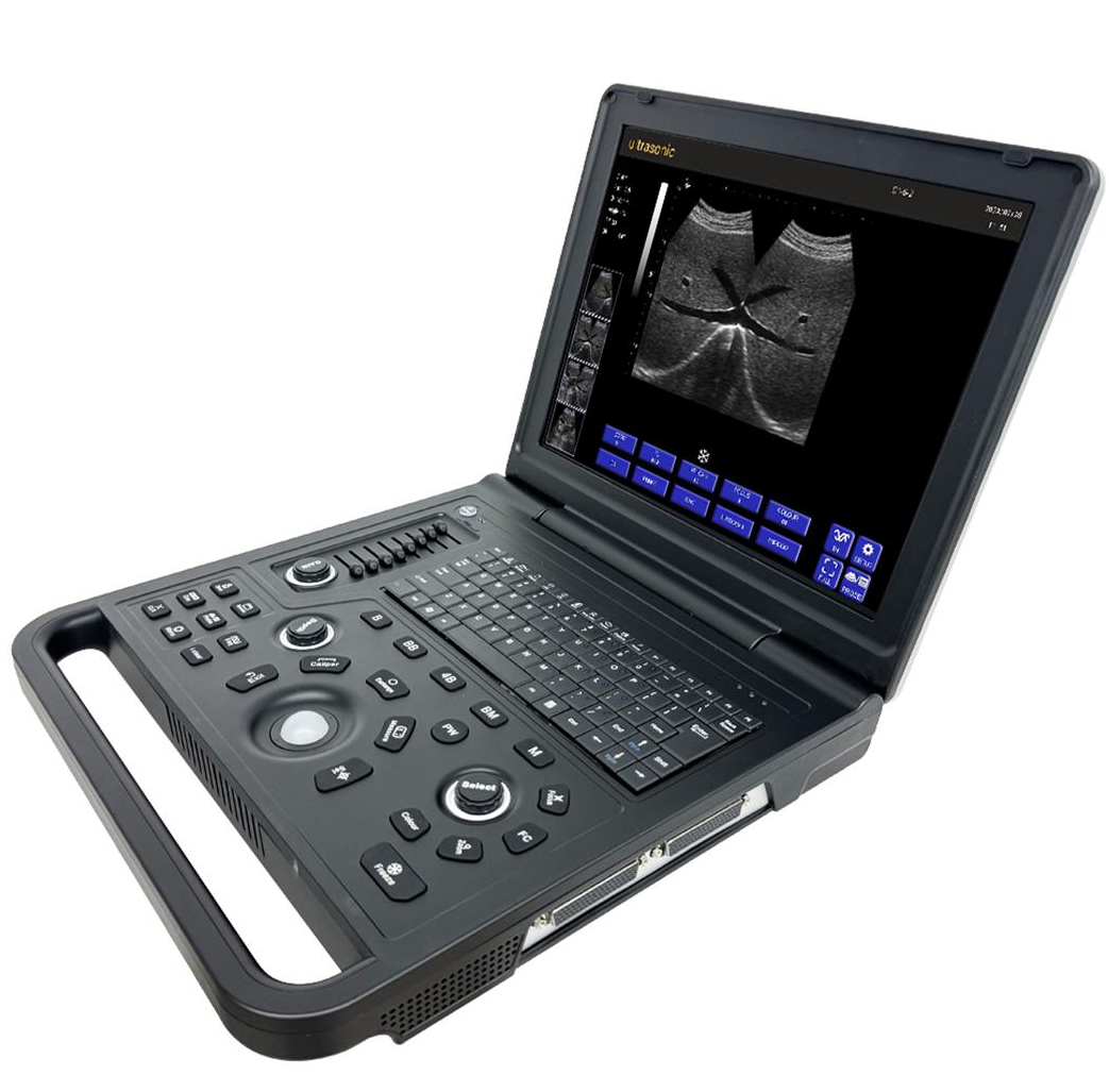 MBW-5P Medical Portable Full Digital B/W Ultrasound Scanner