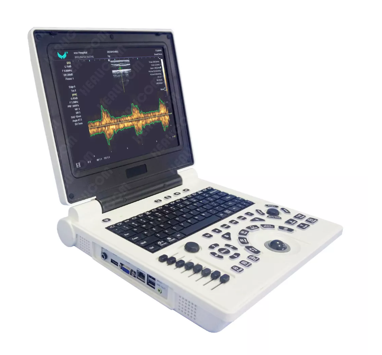 MBW-6P Full Digital Laptop B/W Ultrasound Scanner