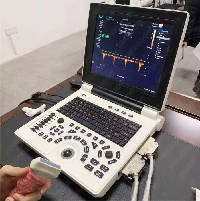  Full Digital Laptop B/W Ultrasound Scanner