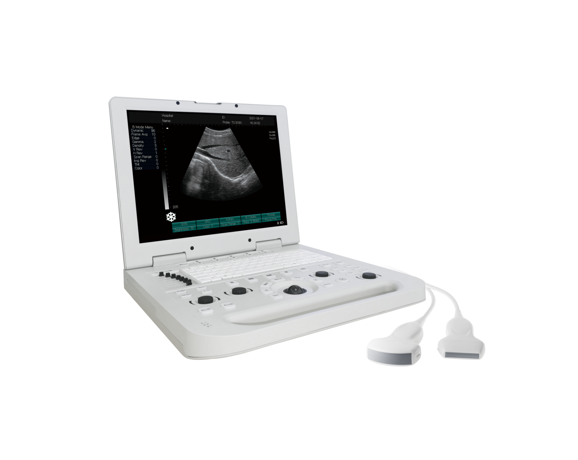MBW-8 Full Digital Portable Laptop B/W Ultrasound Scanner