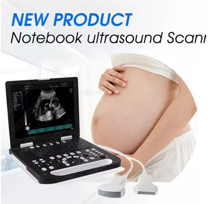 Full Digital Portable Laptop B/W Ultrasound Scanner