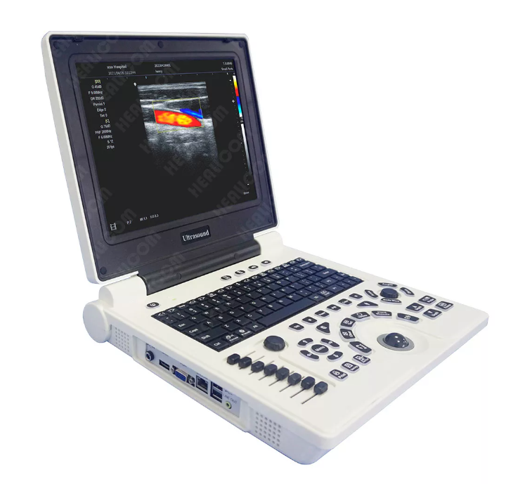 MUC-180 Laptop Color Doppler Ultrasound Scanner