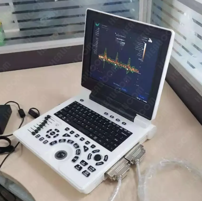 MUC-180 Laptop Color Doppler Ultrasound Scanner