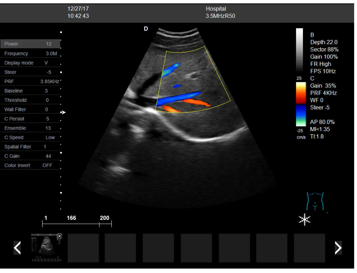  Laptop Color Doppler Ultrasound Scanner