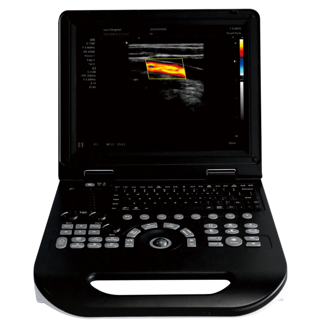MUC-200 Laptop Color Doppler Ultrasound Scanner