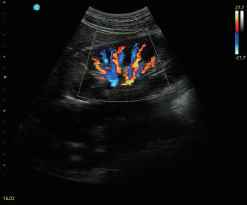 Portable Color Doppler Ultrasound Scanner