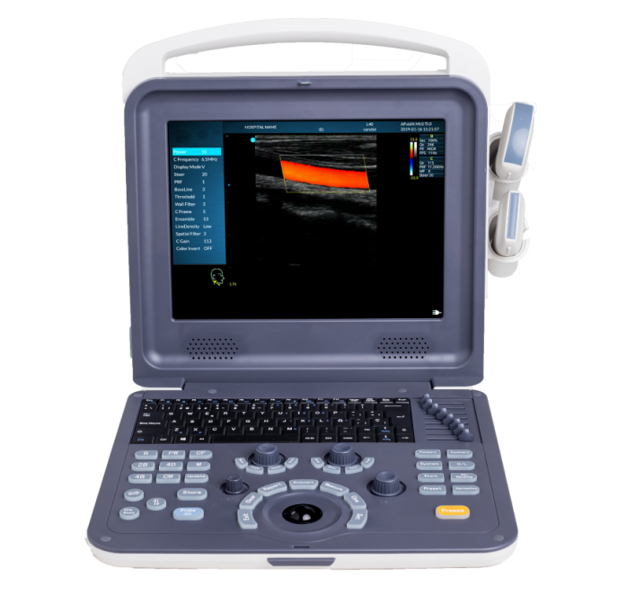 MUC-260 Portable Color Doppler Ultrasound Scanner