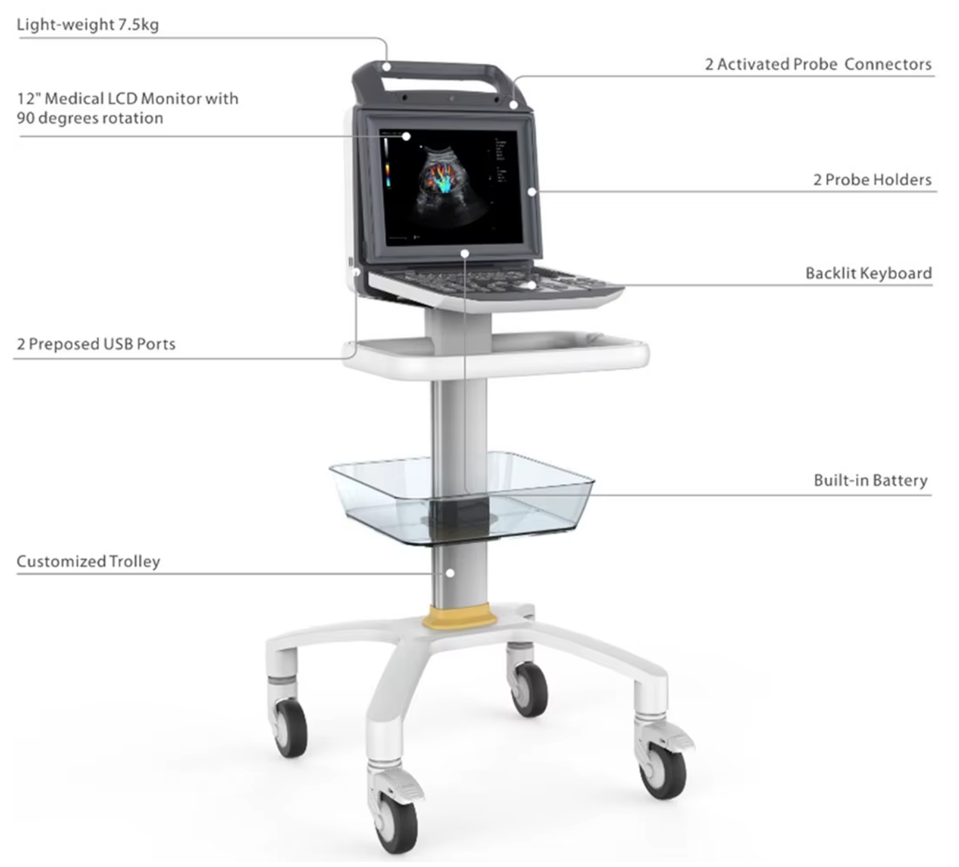 MUC-320 Hand-carried Color doppler Ultrasound Diagnostic System