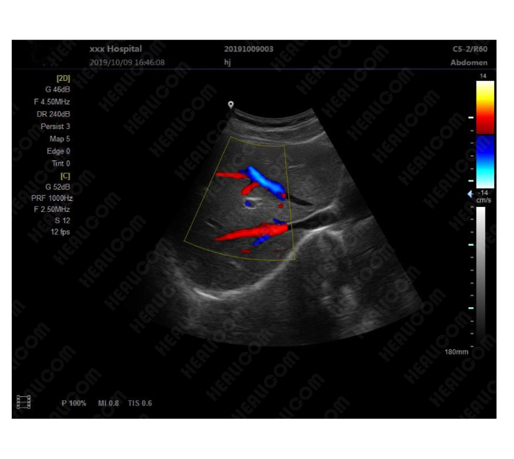 MUC-310 Medical Portable Color Doppler Ultrasound Scanner
