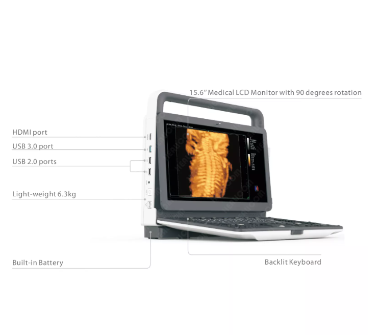 MUC-500 Portable 4D Color Doppler Ultrasonic Diagnostic System