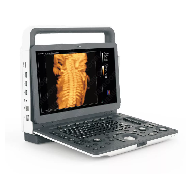 MUC-500 Portable 4D Color Doppler Ultrasonic Diagnostic System