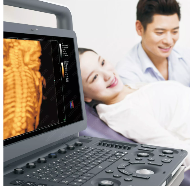 MUC-500 Portable 4D Color Doppler Ultrasonic Diagnostic System