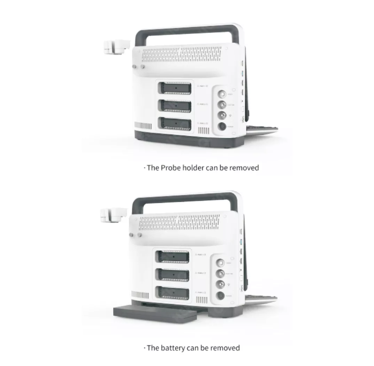 MUC-500 Portable 4D Color Doppler Ultrasonic Diagnostic System