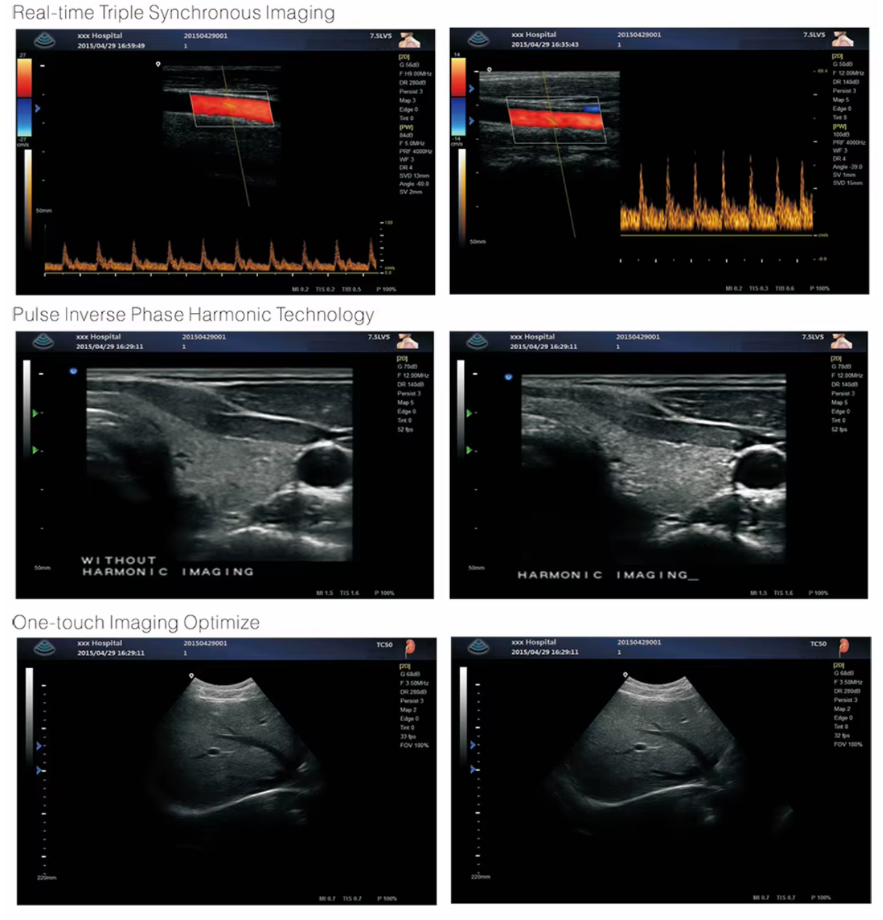 MUC-700 4D Trolley Color Doppler Ultrasound Scanner M