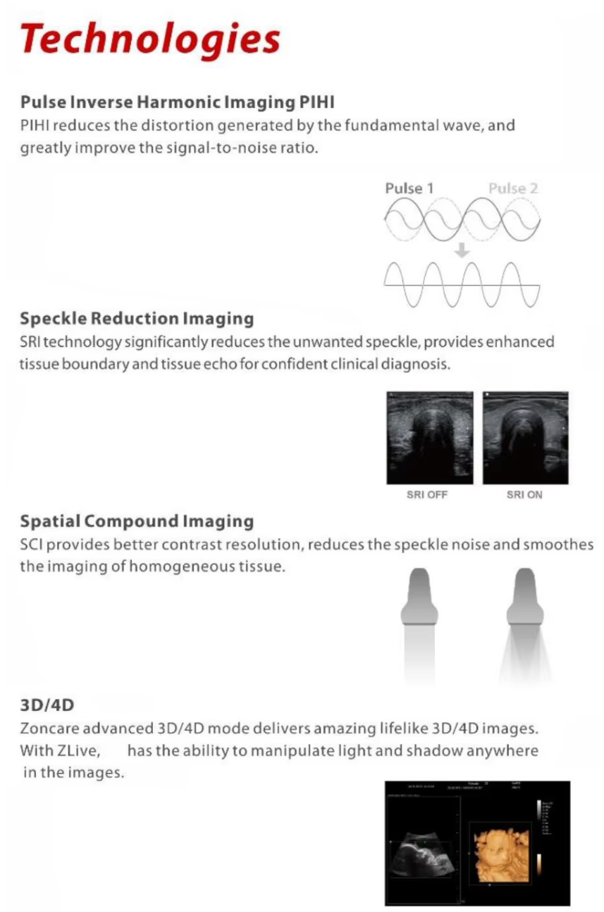 MUC-950N  Medical 4D Full Digital Trolley Color Doppler Ultrasound
