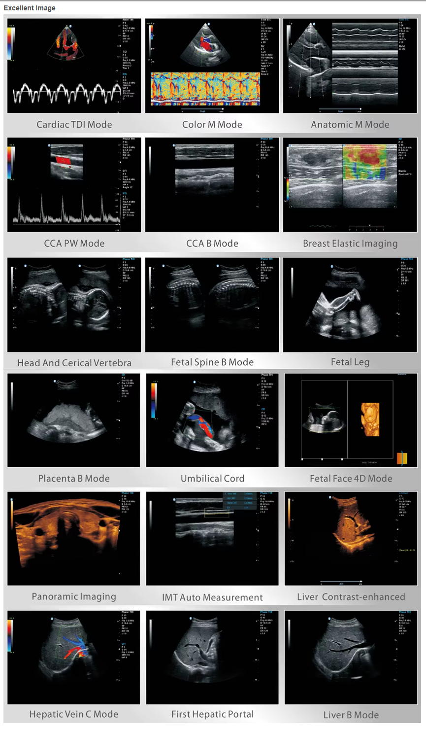 MUC-950N  Medical 4D Full Digital Trolley Color Doppler Ultrasound