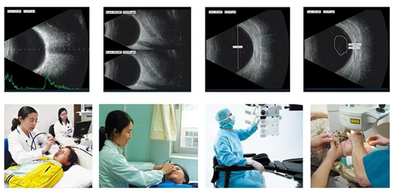 MO-1000 Ophthalmic Ultrasound A Scan with Pachymeter