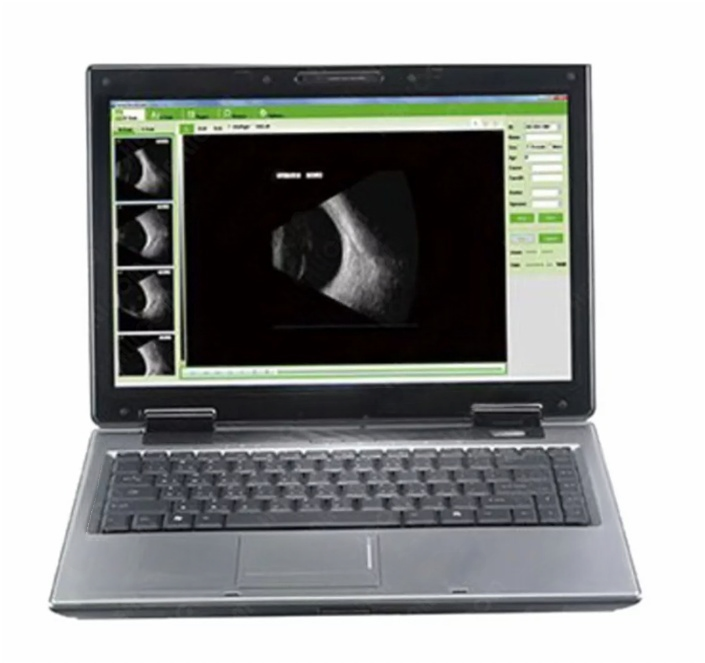 MO-200 Ophthalmic A/B ultrasound box scanner