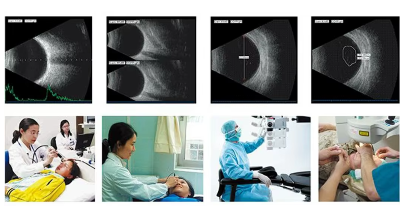 MO-200 Ophthalmic A/B ultrasound box scanner