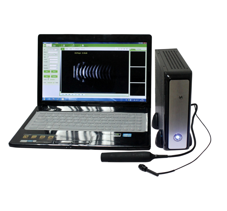 MO-200 Ophthalmic A/B ultrasound box scanner