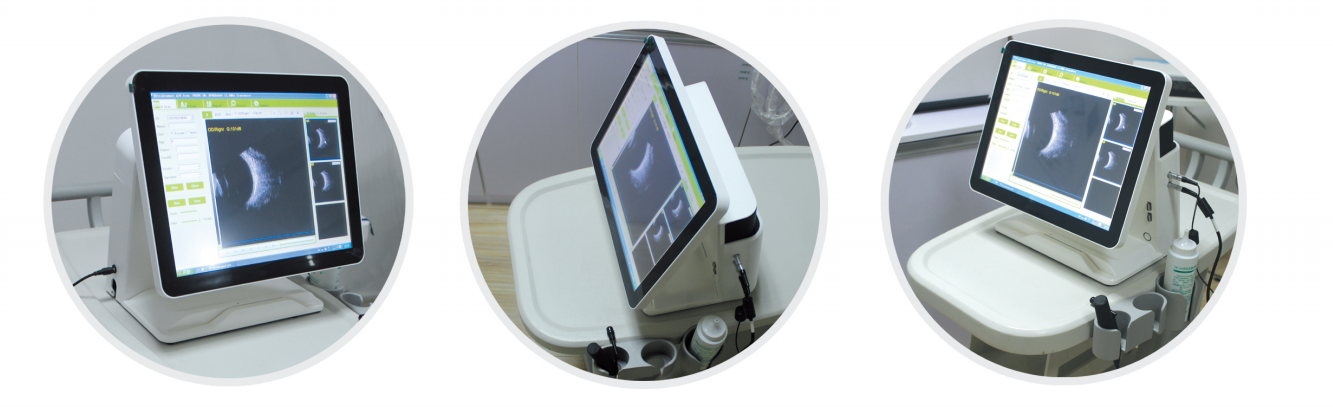 MO-500 Medical Full Digital Ophthalmic A B Ultrasound Scanner